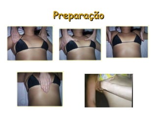 Preparação

 