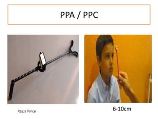 PPA / PPC
6-10cm
Regla Pince
 