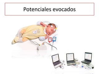 Potenciales evocados
 
