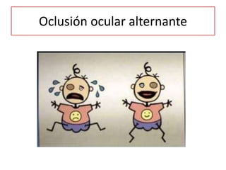 Oclusión ocular alternante
 