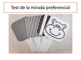 Test de la mirada preferencial
 