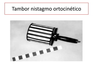 Tambor nistagmo ortocinético
 