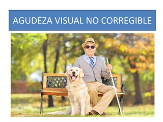 AGUDEZA VISUAL NO CORREGIBLE
 