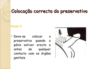 Colocação correcta do preservativo Passo 4  Deve-se colocar o preservativo quando o pénis estiver erecto e antes de qualquer contacto com os órgãos genitais. 