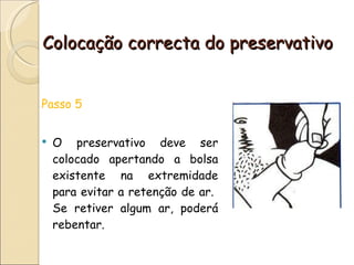 Colocação correcta do preservativo Passo 5 O preservativo deve ser colocado apertando a bolsa existente na extremidade para evitar a retenção de ar.  Se retiver algum ar, poderá rebentar. 