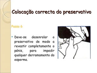 Colocação correcta do preservativo Passo 6 Deve-se desenrolar o preservativo de modo a revestir completamente o pénis, para impedir qualquer derramamento do esperma. 