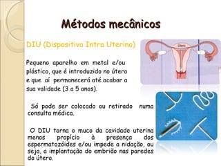 Métodos mecânicos DIU (Dispositivo Intra Uterino) Pequeno  aparelho  em  metal  e/ou  plástico, que é introduzido no útero  e que  aí  permanecerá até acabar a  sua validade (3 a 5 anos). Só pode ser colocado ou retirado  numa consulta médica. O DIU torna o muco da cavidade uterina menos propício à presença dos espermatozóides e/ou impede a nidação, ou seja, a implantação do embrião nas paredes do útero. 