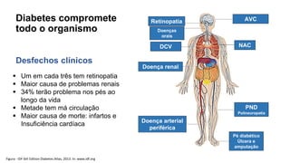 Por um cuidado certo - Sociedade Brasileira de Diabetes Slide 17