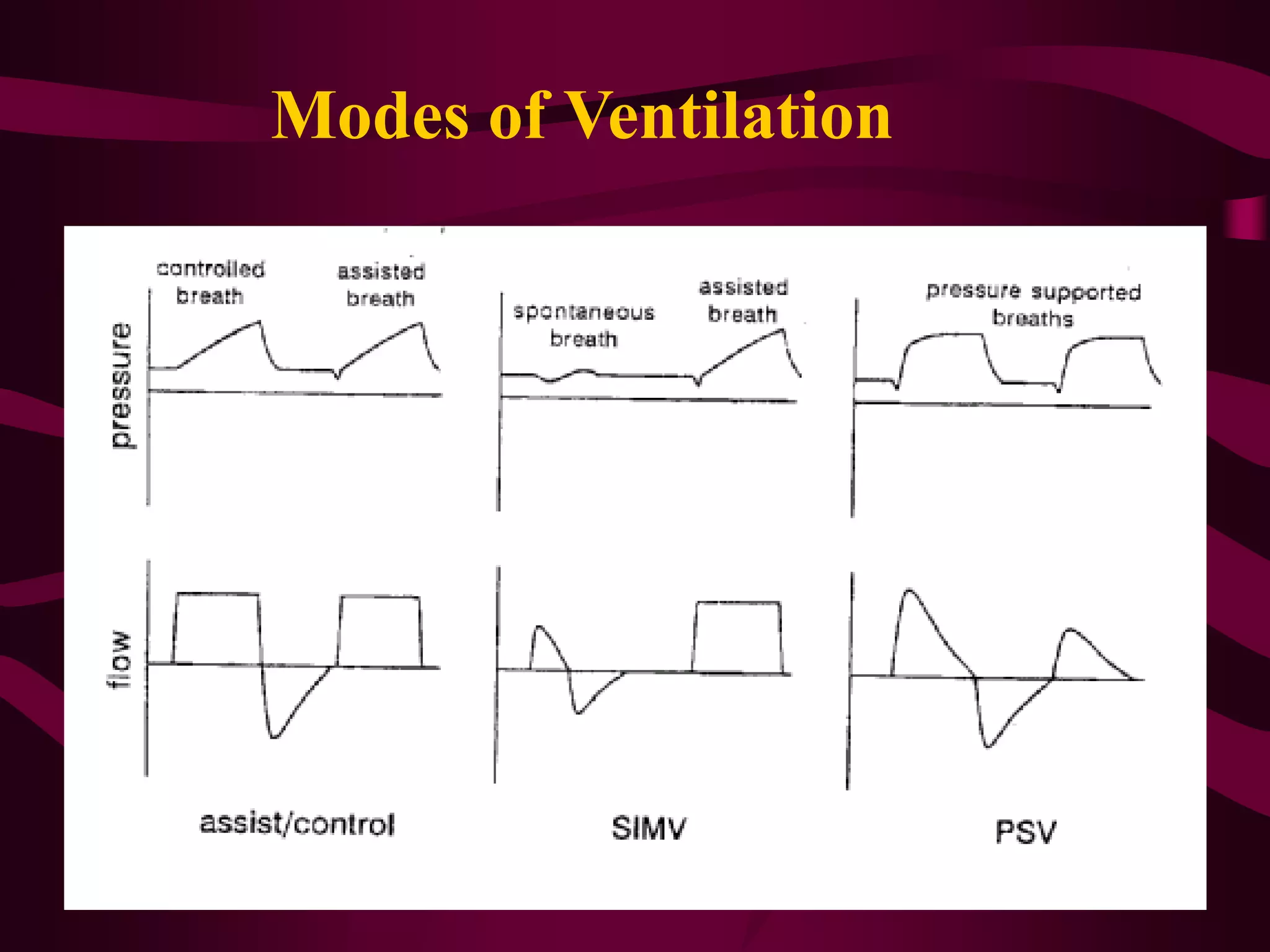 Modes of Ventilation
 