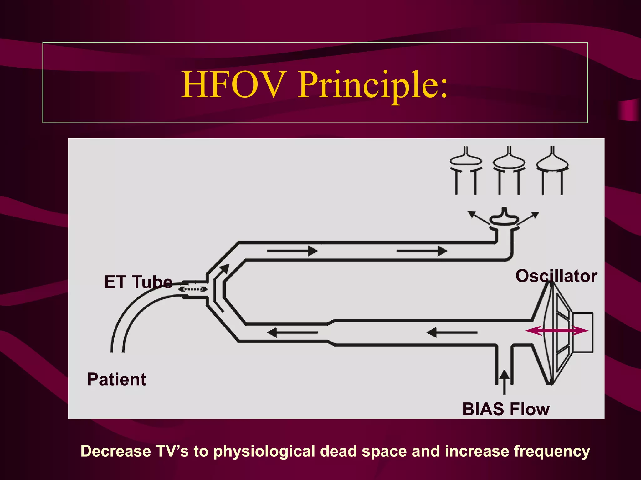 HFOV Principle:



  ET Tube                                             Oscillator




Patient
                                               BIAS Flow

Decrease TV’s to physiological dead space and increase frequency
 