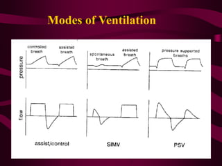 Modes of Ventilation
 