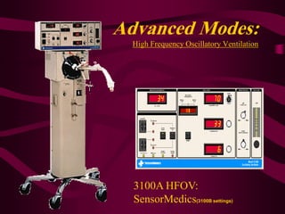 Advanced Modes:
  High Frequency Oscillatory Ventilation




  3100A HFOV:
  SensorMedics(3100B settings)
 