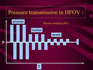 Pressure transmission in HFOV :
     proximal
                          Pressure damping effect

                trachea
                                  alveoli


P




                    T
 