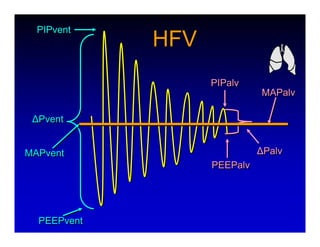 High Frequency Ventillation