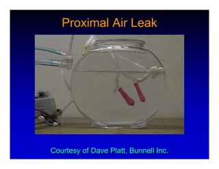 High Frequency Ventillation