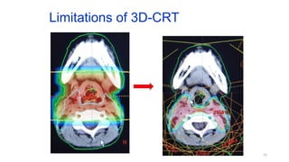 role of RT in pediatric CNS Tumors .pptx