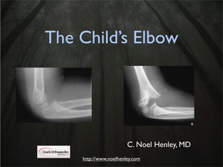 The Child’s Elbow




                       C. Noel Henley, MD
    http://www.noelhenley.com
 