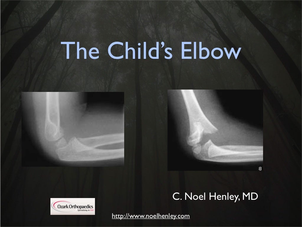 Pediatric Elbow Examination and Xrays