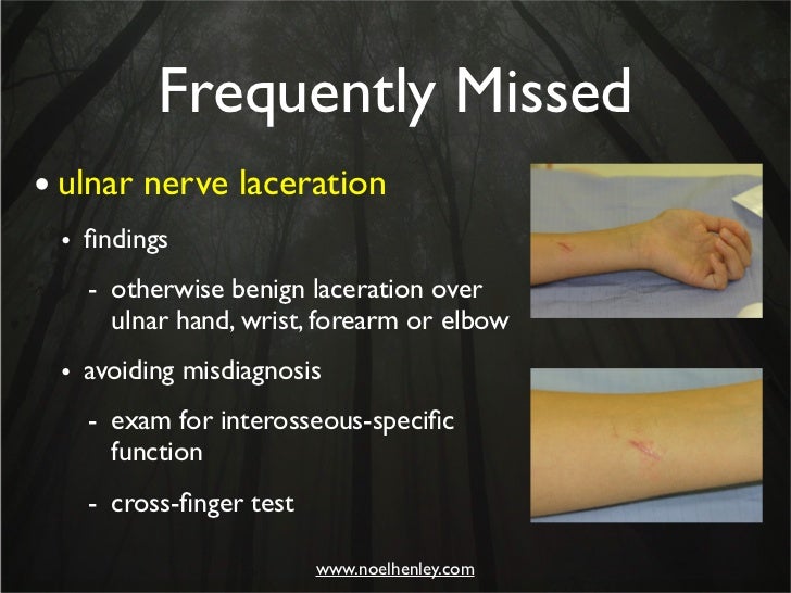 Pediatric Hand Injuries Evaluation, Diagnosis