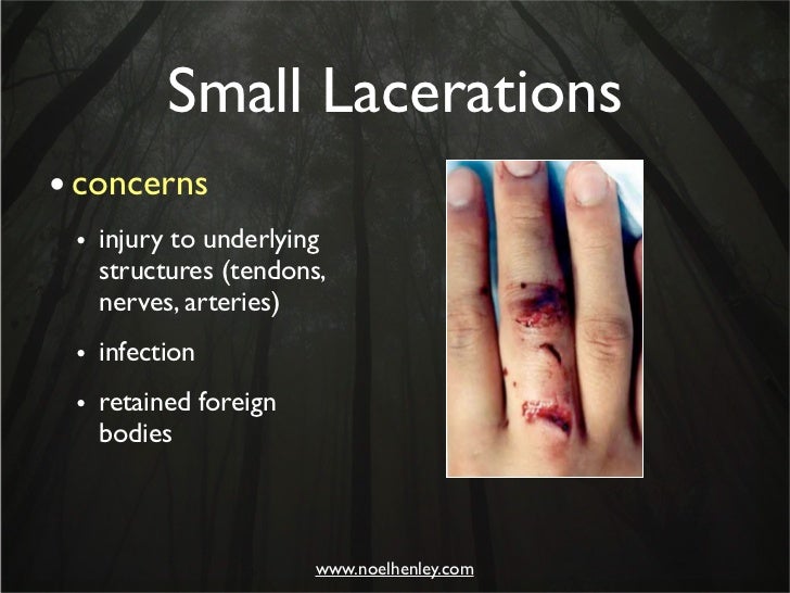 Pediatric Hand Injuries Evaluation, Diagnosis