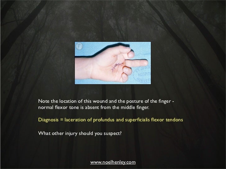 Pediatric Hand Injuries Evaluation, Diagnosis