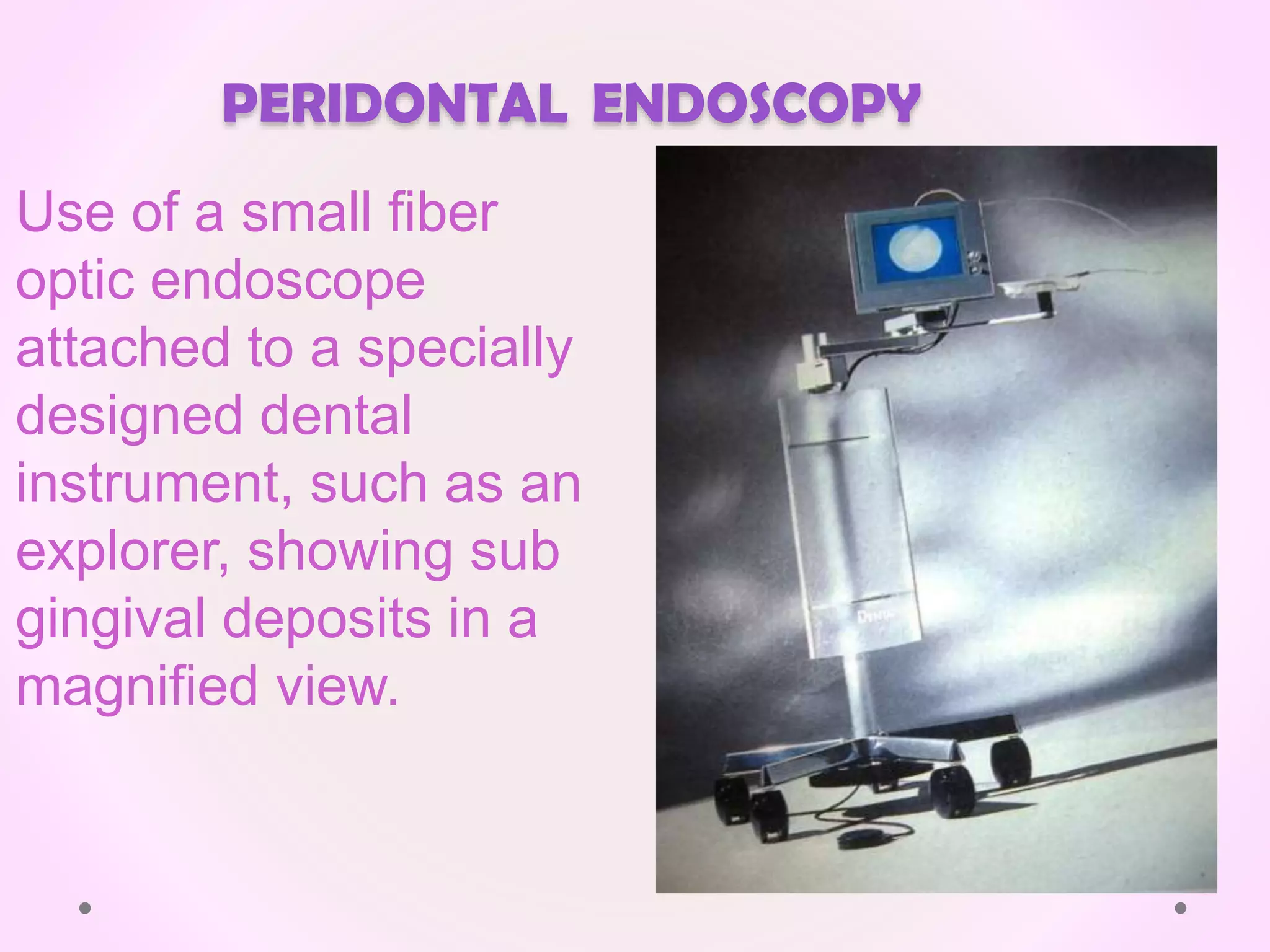 PERIDONTAL ENDOSCOPY
Use of a small fiber
optic endoscope
attached to a specially
designed dental
instrument, such as an
explorer, showing sub
gingival deposits in a
magnified view.
 