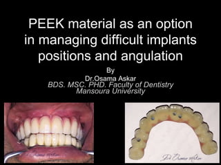 PEEK material as an option
in managing difficult implants
positions and angulation
By
Dr.Osama Askar
BDS. MSC. PHD. Faculty of Dentistry
Mansoura University
 