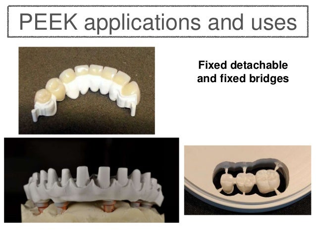 peek material in dentistry peek material in dentistry