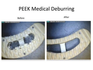 PEEK Medical Deburring
Before After
 