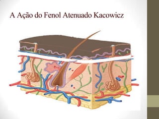A Ação do Fenol Atenuado Kacowicz
 