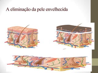 A eliminação da pele envelhecida
 