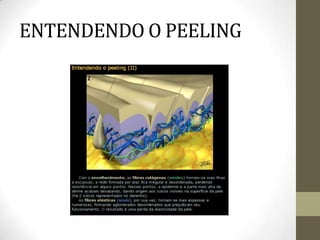 ENTENDENDO O PEELING
 