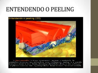 ENTENDENDO O PEELING
 