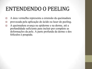 ENTENDENDO O PEELING
 A área vermelha representa a extensão da queimadura
 provocada pela aplicação do ácido ou laser do peeling.
 A queimadura avança na epiderme e na derme, até a
profundidade suficiente para incluir por completo as
deformações da pele. A parte profunda da derme e dos
folículos é poupada.
 