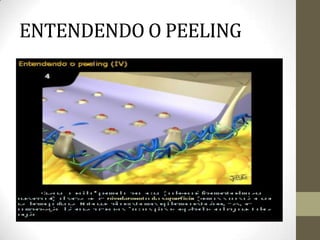ENTENDENDO O PEELING
 