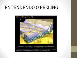 ENTENDENDO O PEELING
 