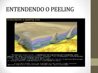 ENTENDENDO O PEELING
 