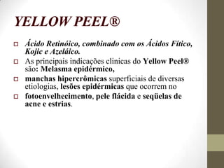 YELLOW PEEL®
 Ácido Retinóico, combinado com os Ácidos Fítico,
Kojic e Azeláico.
 As principais indicações clinicas do Yellow Peel®
são: Melasma epidérmico,
 manchas hipercrômicas superficiais de diversas
etiologias, lesões epidérmicas que ocorrem no
 fotoenvelhecimento, pele flácida e seqüelas de
acne e estrias.
 