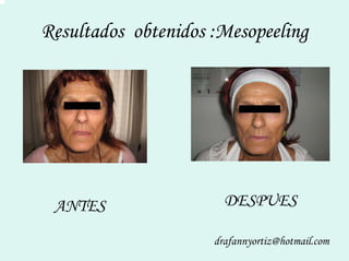 Peelling Rostoro Cuello