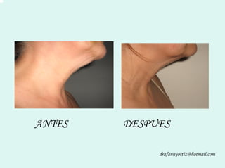 Peelling Rostoro Cuello