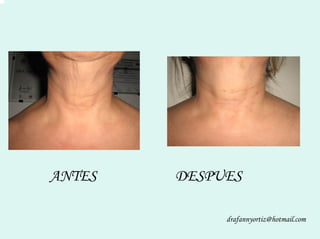 Peelling Rostoro Cuello