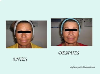 Peelling Rostoro Cuello