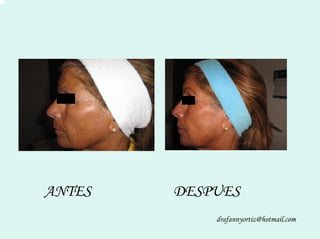 Peelling Rostoro Cuello