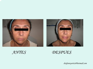 Peelling Rostoro Cuello