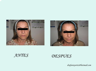 Peelling Rostoro Cuello