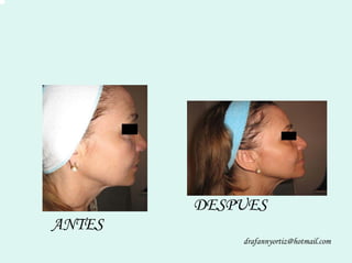 Peelling Rostoro Cuello