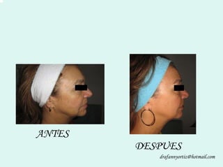 Peelling Rostoro Cuello