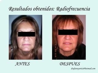 Peelling Rostoro Cuello