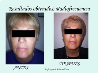 Peelling Rostoro Cuello