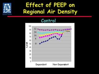 Effect of PEEP on Regional Air Density Control 32 24 16 8 0 Dependent Non-Dependent 32 24 16 8 0 Denver Health 